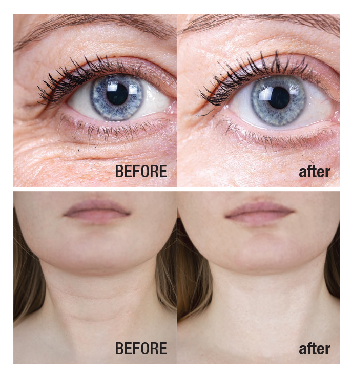 Skin Restore+